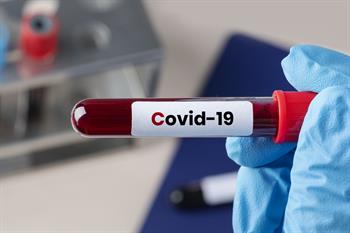 COVID-19 Lab COVID-19 Pilot Grant